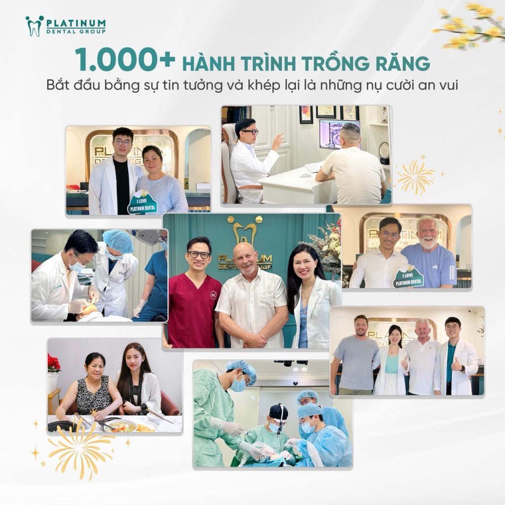 Trồng răng Implant 48 hanh trinh trong rang implant Large
