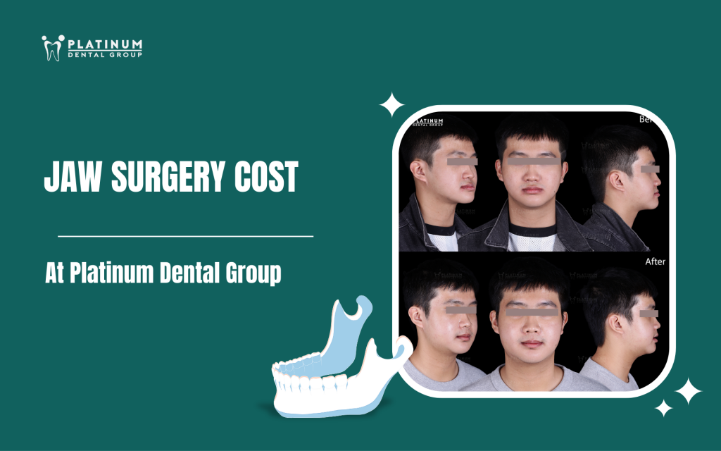 jaw surgery cost