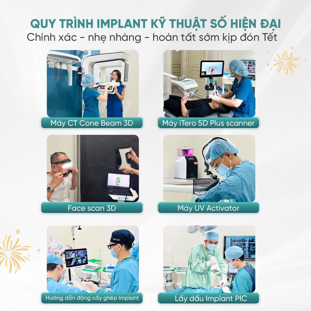 Trồng răng Implant 46 quy trinh implant hien dai Large