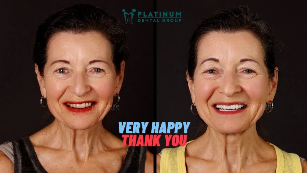 THẬT HẠNH PHÚC VÀ BIẾT ƠN CÁC BÁC SĨ TẠI PLATINUM CHIA SẺ TỪ CÔ NOELINE ROSE (ÚC)