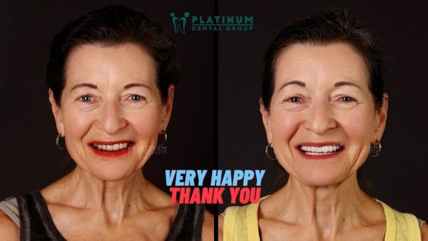 THẬT HẠNH PHÚC VÀ BIẾT ƠN CÁC BÁC SĨ TẠI PLATINUM CHIA SẺ TỪ CÔ NOELINE ROSE (ÚC)