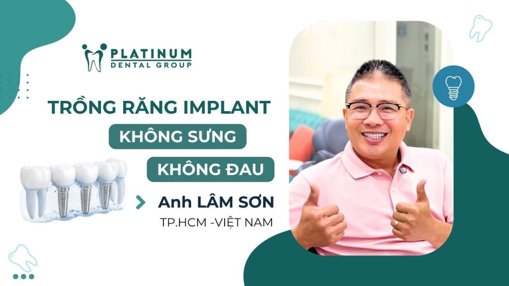 KẾT QUẢ NGOÀI MONG ĐỢI SAU CẤY GHÉP IMPLANT – CHIA SẺ TỪ MR. LÂM SƠN