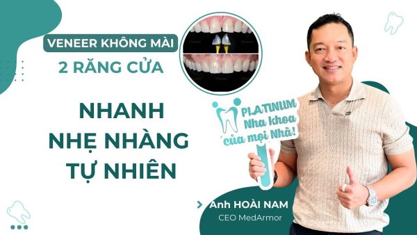 VENEER RĂNG KHÔNG MÀ TRẢI NGHIỆM NHẸ NHÀNG CỦA ANH HOÀI NAM