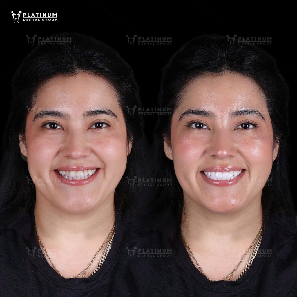 Daily Hernandez thumb