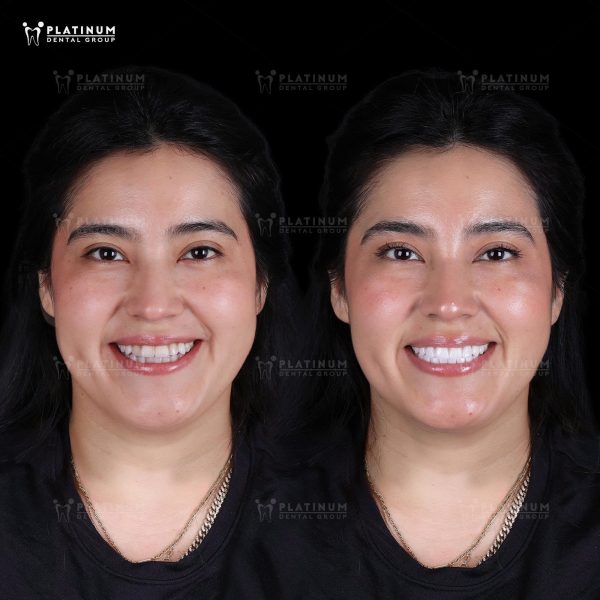 Daily Hernandez thumb