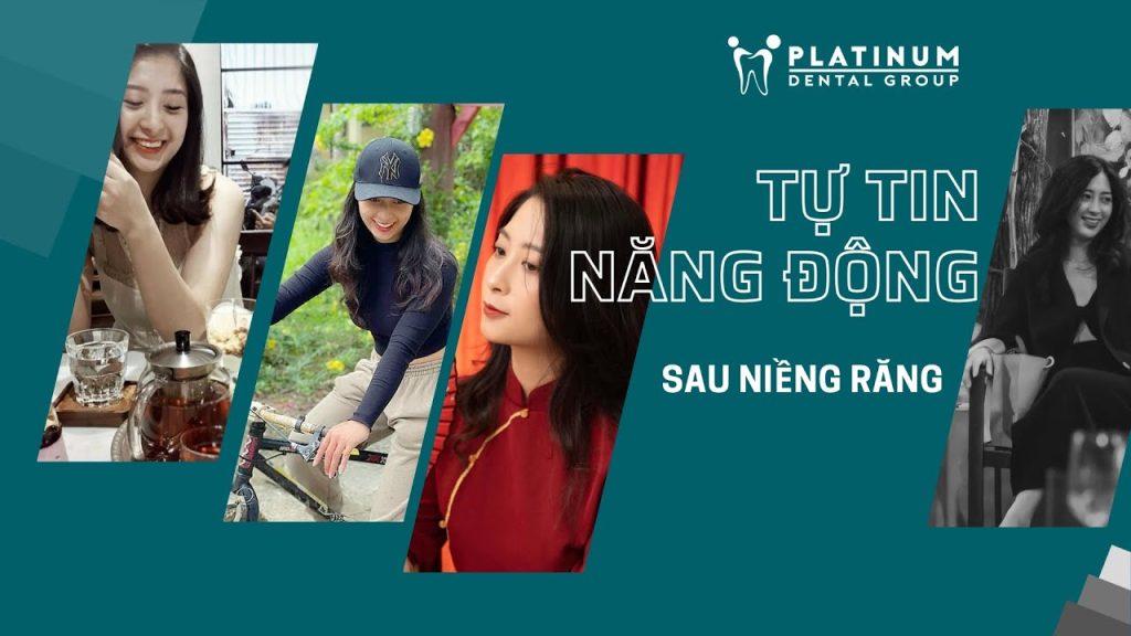 Niềng răng ở tuổi 27: Khi tôi quyết định thay đổi nụ cười của mình - Chia sẻ của chị Hồ Linh