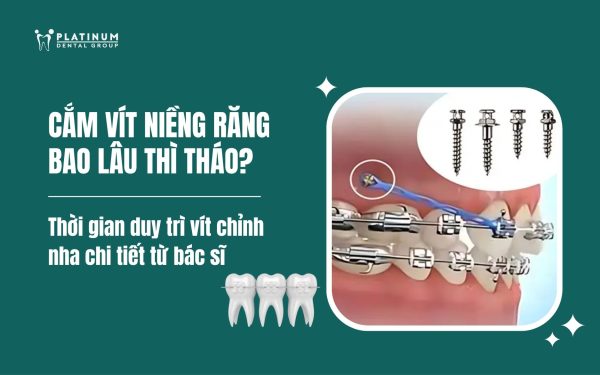 Cắm vít niềng răng bao lâu thì tháo