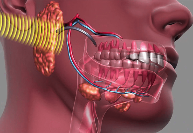 Có rất nhiều nguyên nhân khiến quai hàm kêu lục cục khi nhai