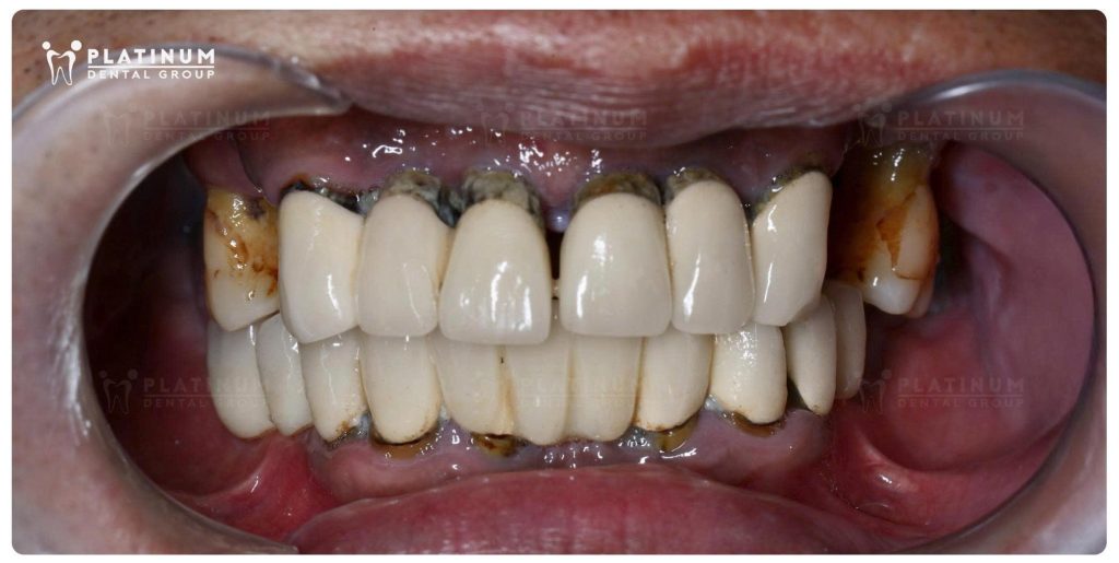 The Challenge: A Highly Complex Clinical Case