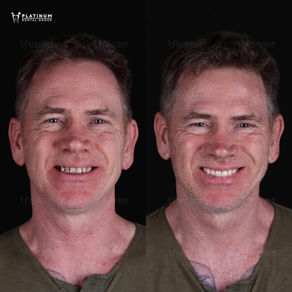  khoảnh khắc Mr. Jeffrey xúc động khi nhìn thấy chính mình trong gương với nụ cười mới