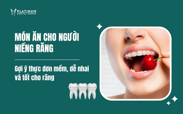 món ăn cho người niềng răng