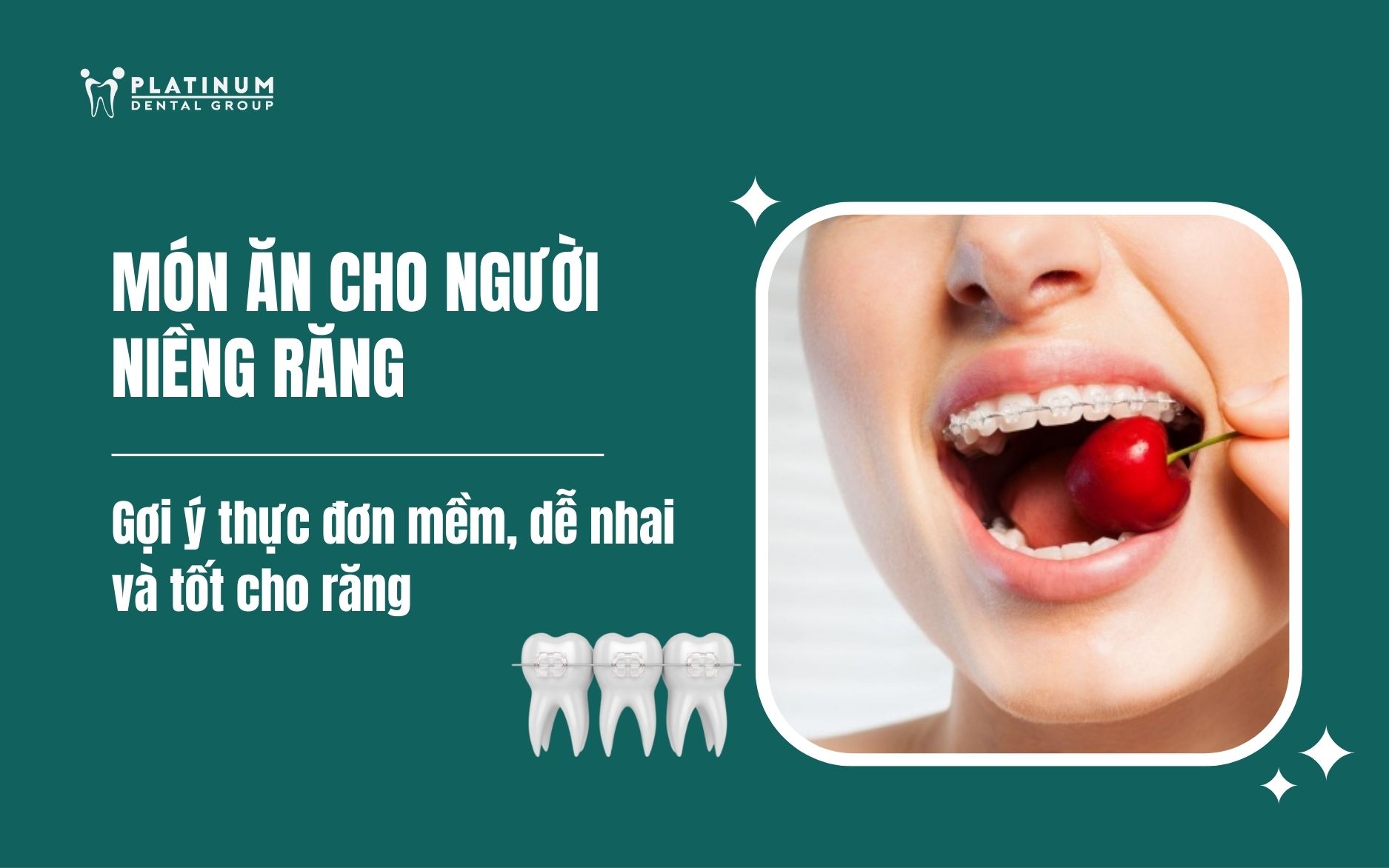 món ăn cho người niềng răng
