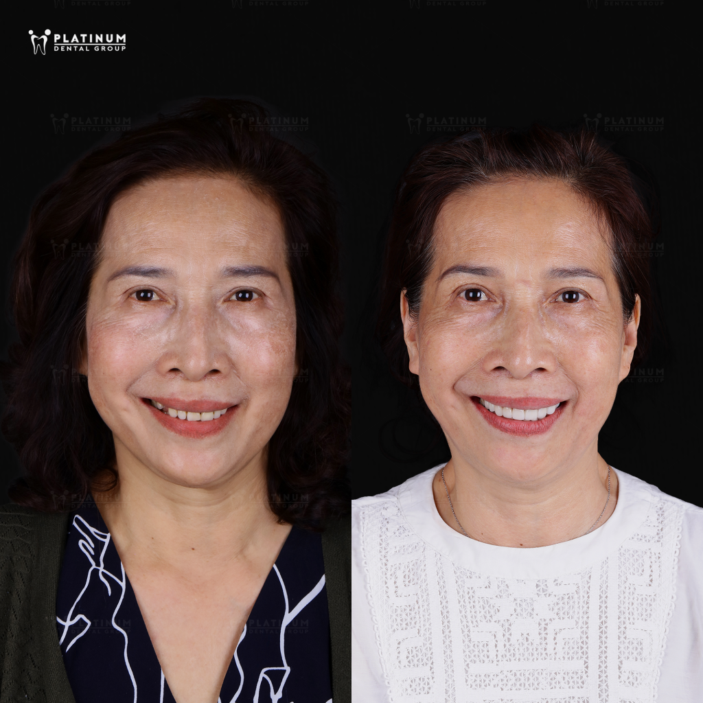 Hồi sinh sức sống mới