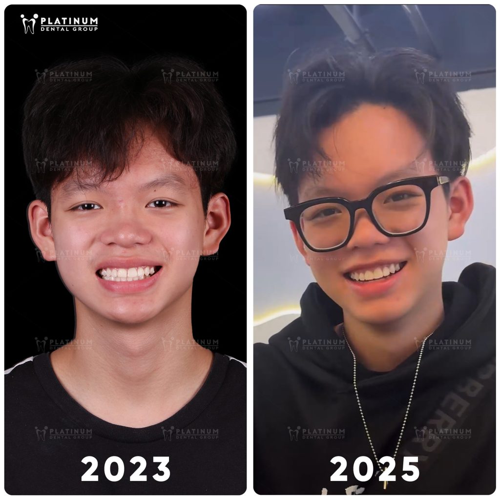 Chỉnh nha tăng trưởng tại Platinum Dental Group hướng đến định hướng lâu dài