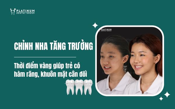 chỉnh nha tăng trưởng