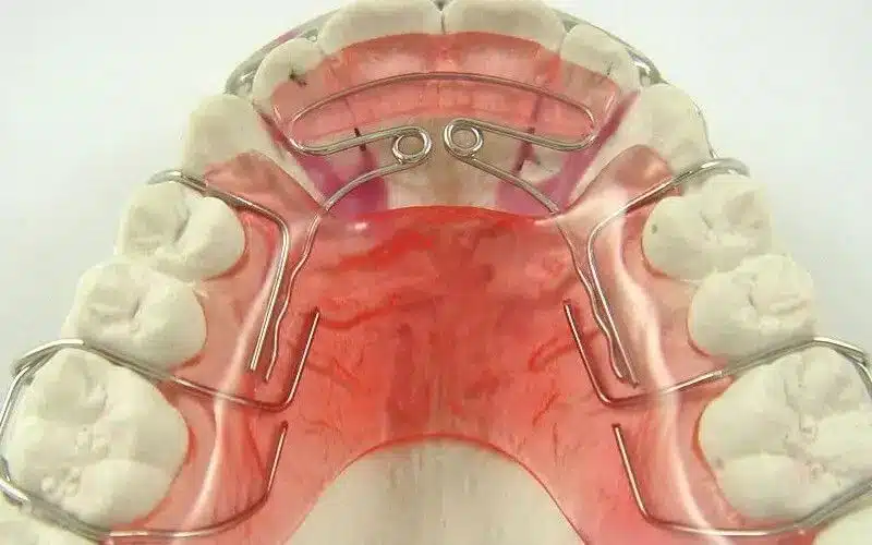 Khí cụ nong hàm tháo lắp