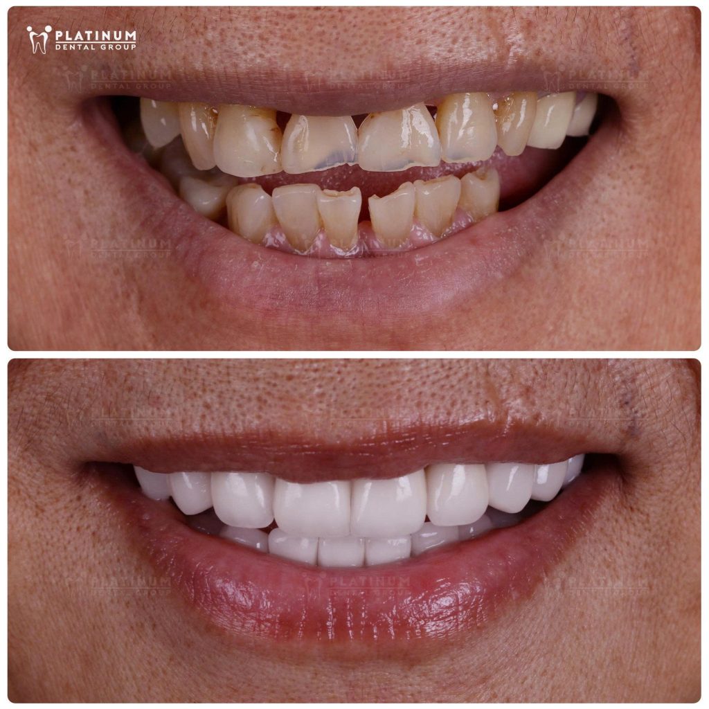 Natural Beauty, Functional Strength