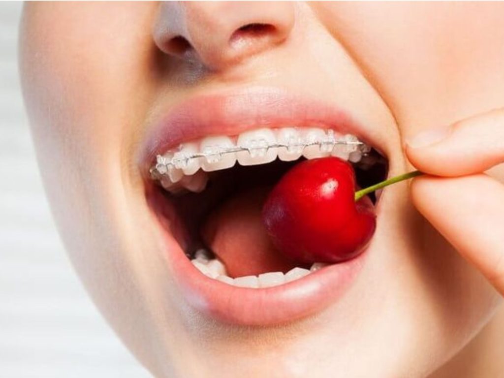 Người bệnh nên lựa chọn thực phẩm phù hợp để giảm cảm giác khó chịu và tránh làm ảnh hưởng đến khí cụ