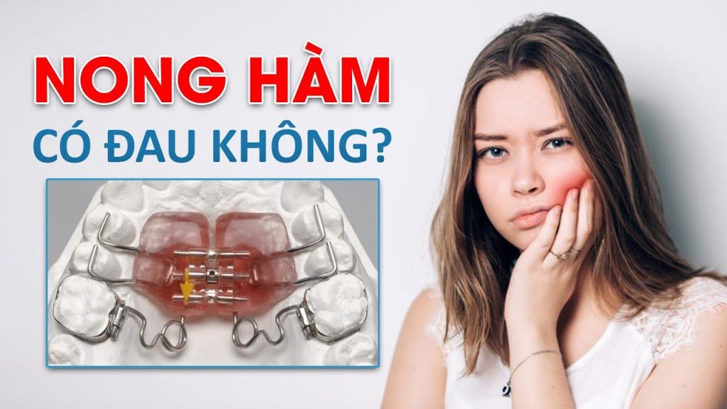 Nong hàm có thể gây cảm giác căng tức nhẹ nhưng thường giảm sau vài ngày