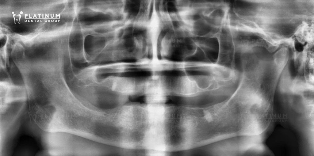 The Initial X-ray Image of Ms. Linda 