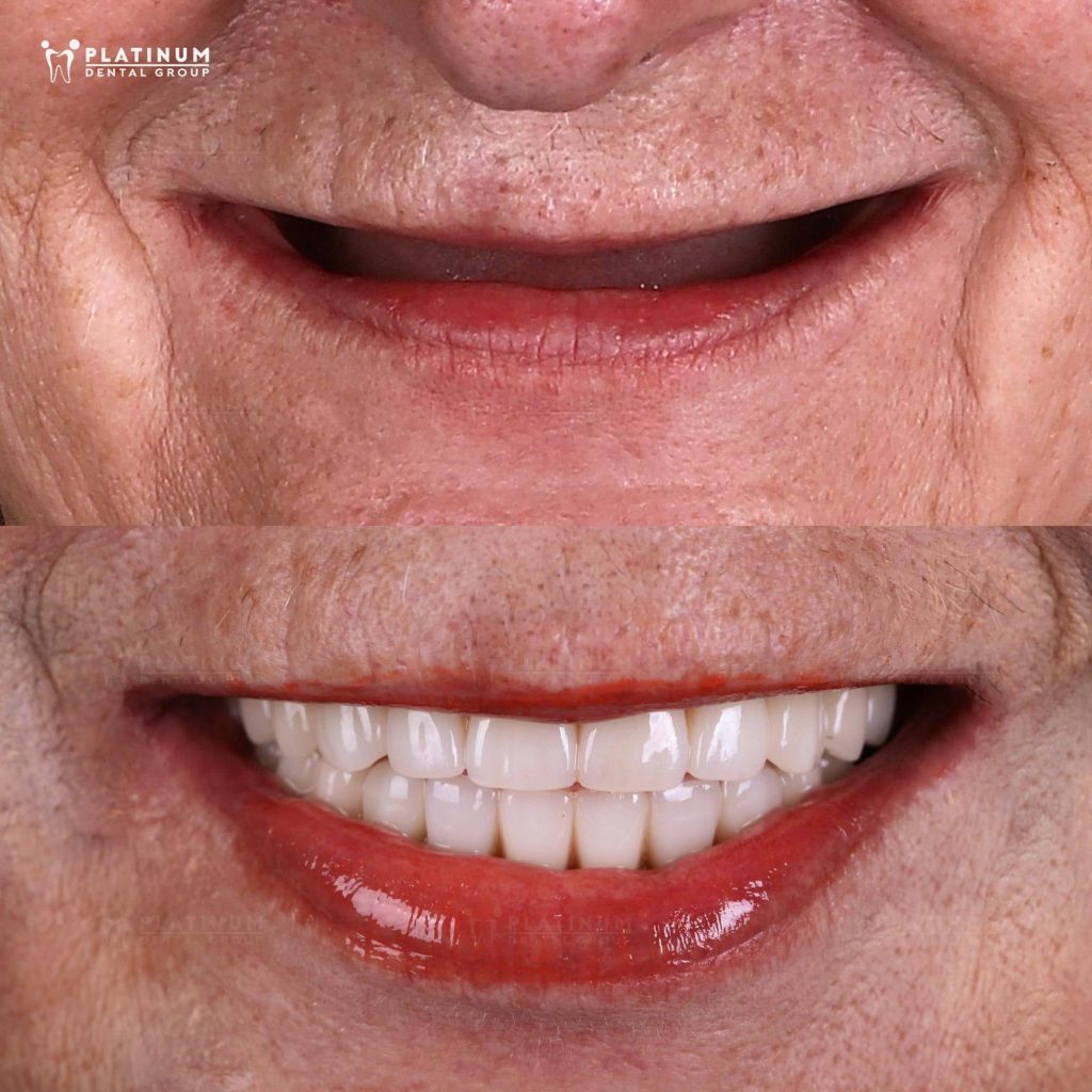 beautiful smile
