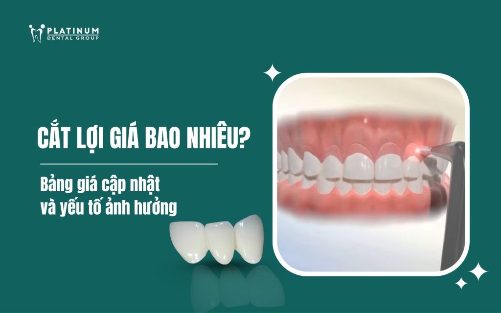 cắt lợi bao nhiêu tiền