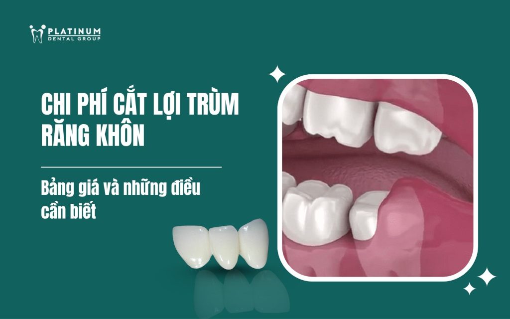 Chi phí cắt lợi trùm