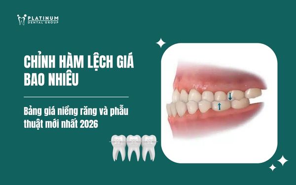 chỉnh hàm lệch giá bao nhiêu