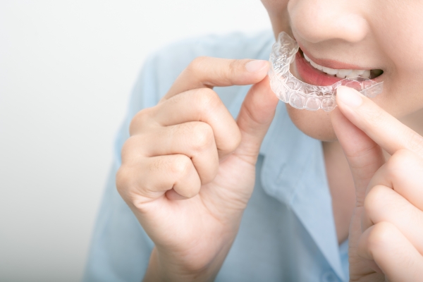 Khay niềng trong suốt Invisalign gần như vô hình, tháo lắp tiện lợi