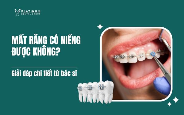 Mất răng có niềng được không