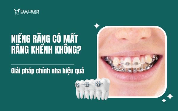 niềng răng có mất răng khểnh không