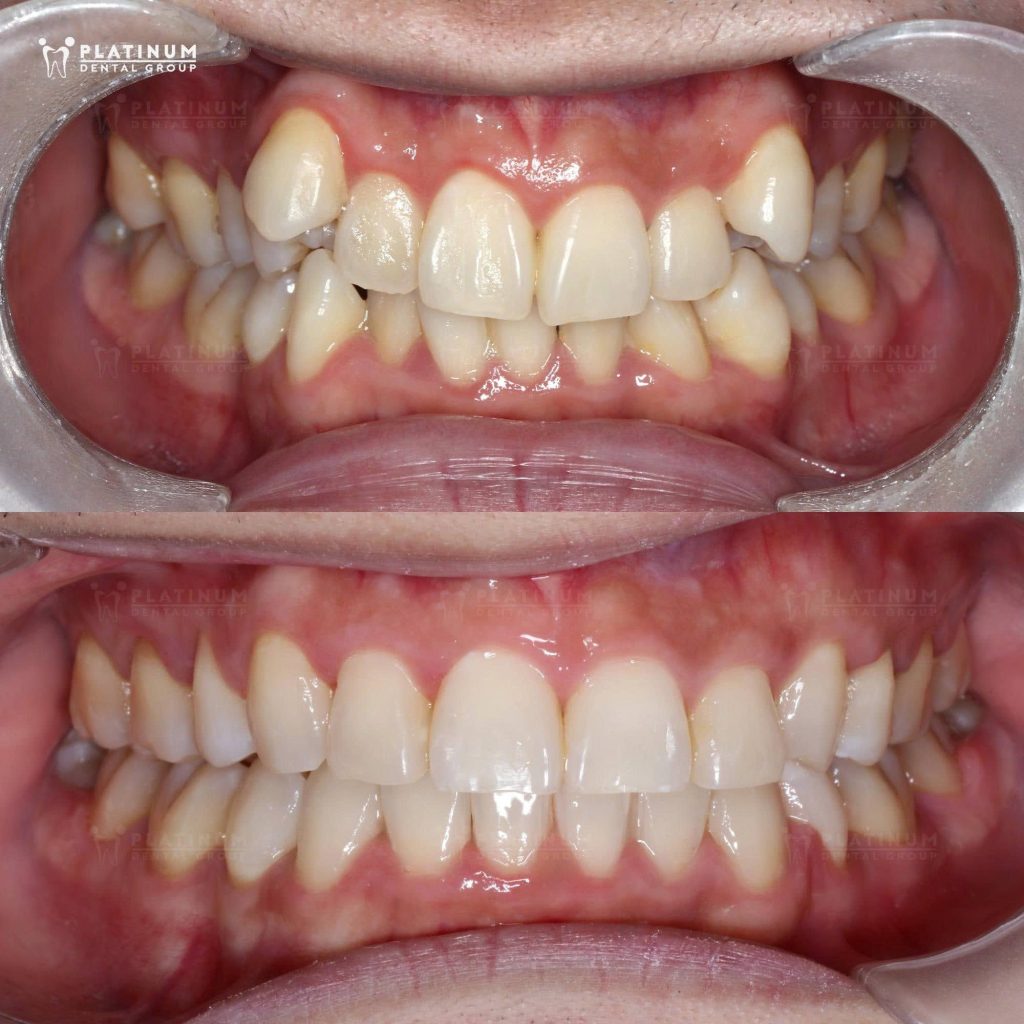 Toàn bộ quá trình diễn ra với những lần tái khám đều đặn
