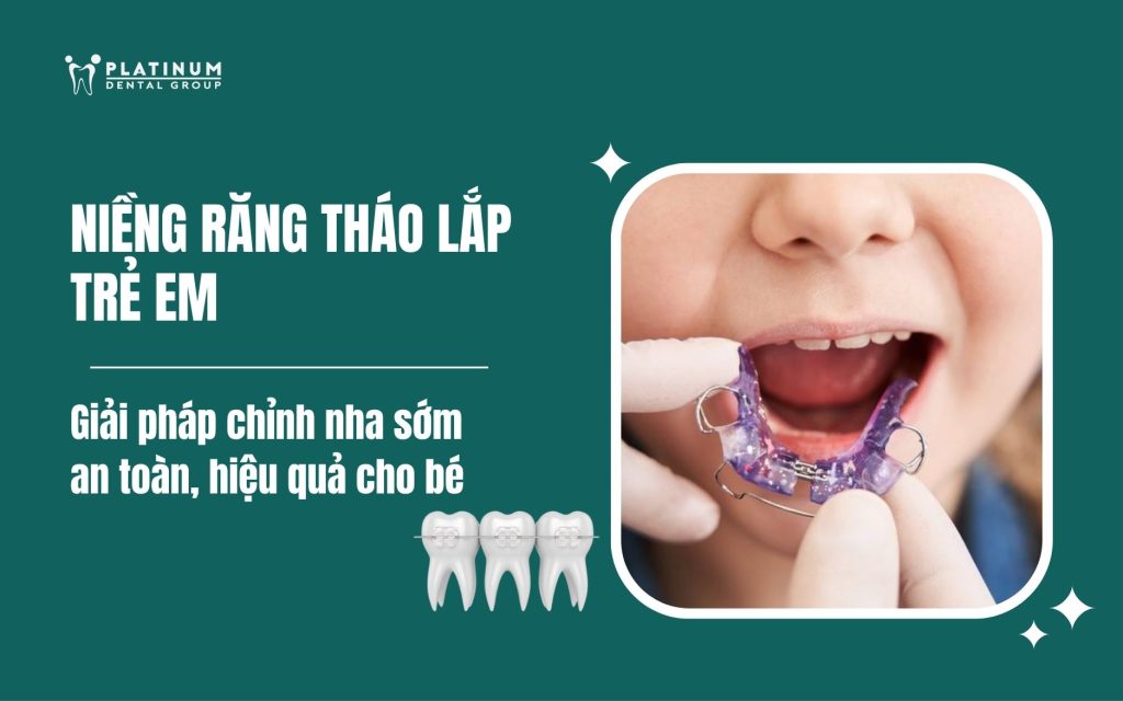 niềng răng tháo lắp trẻ em