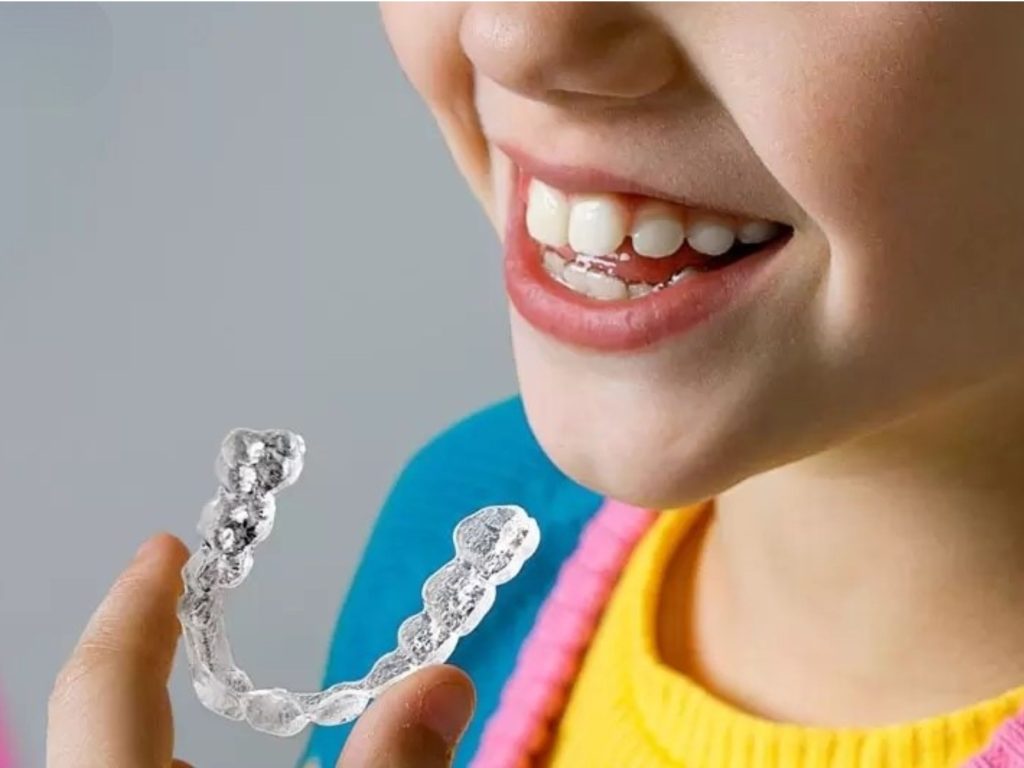 Khay niềng trong suốt được thiết kế bằng nhựa trong, ôm sát răng và gần như khó nhận thấy khi đeo