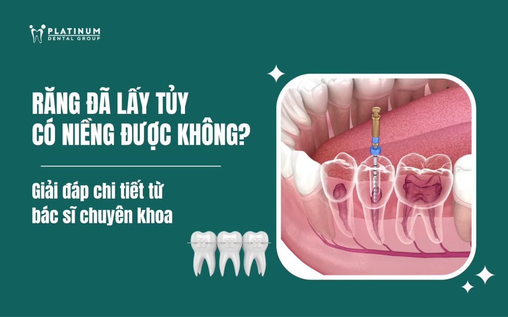 Răng đã lấy tủy có niềng được không