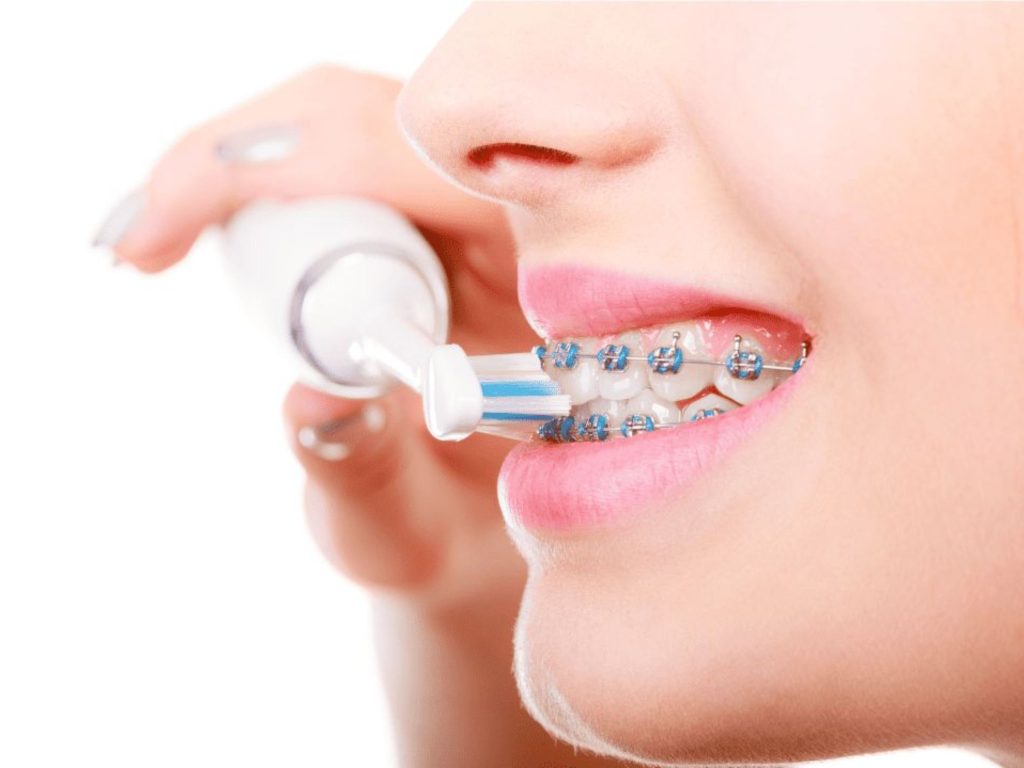 Tìm hiểu răng đã lấy tủy có niềng được không? 6 Đánh răng ít nhất 2–3 lần/ngày, nhất là sau khi ăn